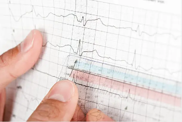 molecular formula molecular formula