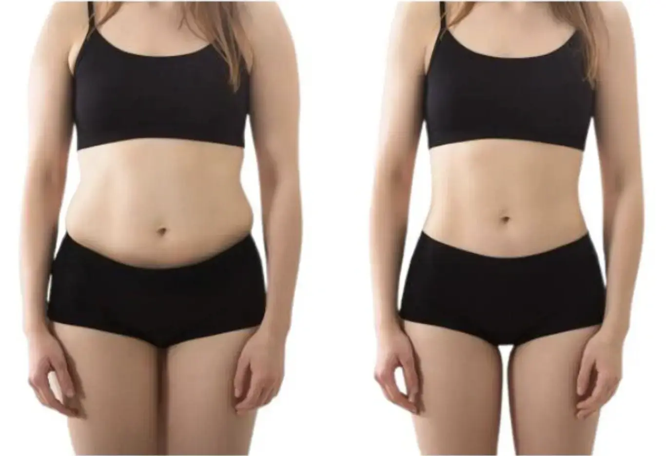 weight loss supplements